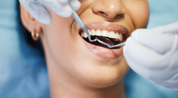 Best Emergency Root Canal Treatment in American Fork, UT